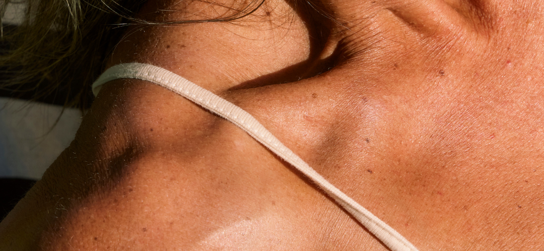¿La menopausia hace que la piel sea más sensible al sol?