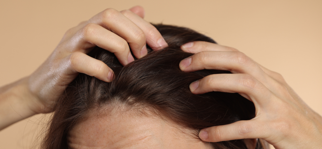 Caída del cabello en primavera: por qué ocurre ahora y qué puedes hacer